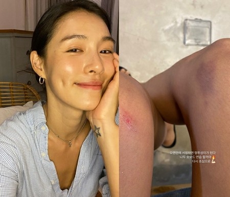 カヒ（元AFTERSCHOOL）、足が傷とあざだらけの理由は…「久しぶりにサーフィンの練習」(WoW!Korea)