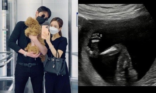 俳優イ・フィリップがパパに…妻パク・ヒョンソン「もう16週!」(朝鮮日報日本語版)