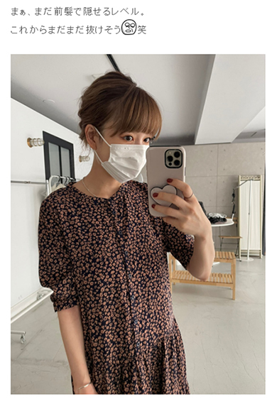 「きゃーーやば」　元あいのり桃、産後の抜け毛に驚愕　薄くなった頭皮に「まだまだ抜けそう」(ねとらぼ)