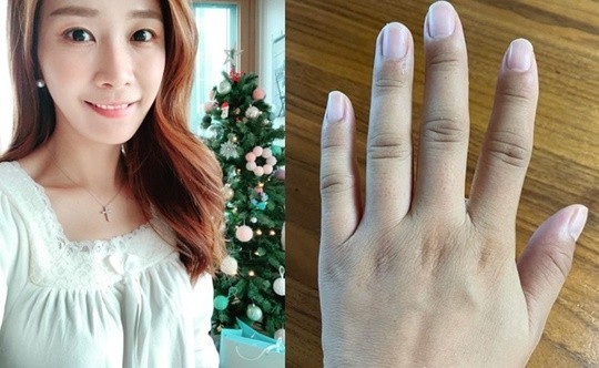 高齢出産を心配する41歳イ・ジョンミン・アナウンサー…「手足がぱんぱんに腫れて」(朝鮮日報日本語版)