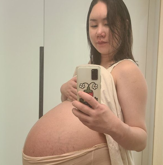 三つ子を妊娠のファン・シニョン「34週で104キロ…お腹がはち切れそうだしだるい」(朝鮮日報日本語版)