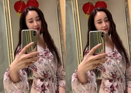 女優ハム・ソウォン、二重手術後の「経過」報告(WoW!Korea)