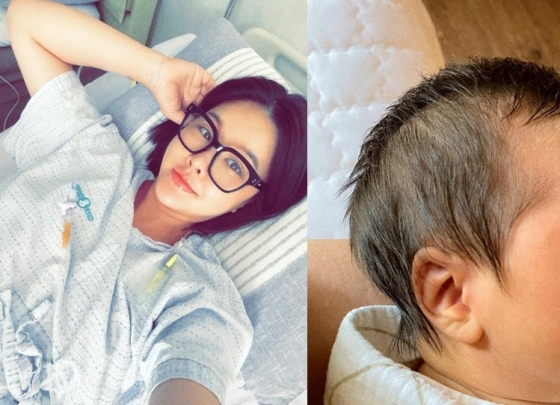 出産パク・ウンジ「手術後の苦痛…肺に水までたまったせいで苦労」(朝鮮日報日本語版)