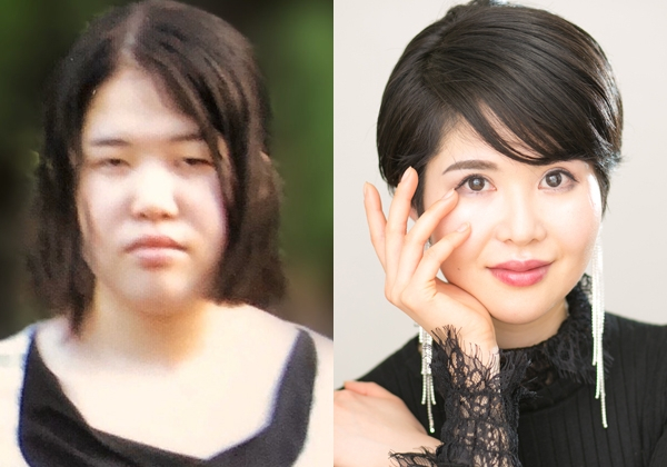 【整形美女】継母の虐待で膨らんだコンプレックス、父親譲りのパーツに嫌悪感…整形によって女性たちが掴んだ“幸せ”とは?(オリコン)