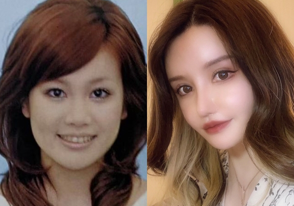 【整形美女】フル整形3周、課金額3000万円…施術をくり返してわかった「他者の評価に流されない軸を持つこと」の大切さ(オリコン)