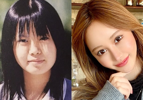 【整形美女】「整形は後ろめたいことじゃない。でも魔法じゃない」自らの施術体験を赤裸々に発信する女性の覚悟と野心(オリコン)