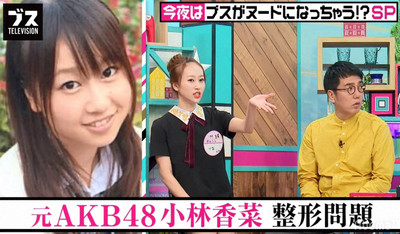 元AKB48小林香菜が整形告白「8年前から多分10回以上」「120、130万円ぐらい」（スポニチアネックス）