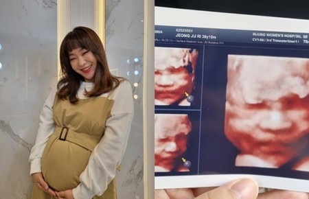 「第4子妊娠」お笑い芸人チョン・ジュリ、「こういうの初めてなので困惑」…25週目の妊娠糖尿病再検査(WoW!Korea)