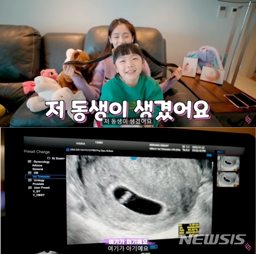 ムン・ヒジュン＆ソユル夫妻に第2子…「つわりがひどくて牛乳とカステラばかり」(朝鮮日報日本語版)