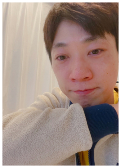 横山だいすけ、泣き腫らしたパンパンの目を公開　号泣の理由に「やばいですよね」「私も見事にはまりました」(ねとらぼ)