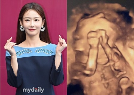「CRAYON POP」出身ソン・ボラム、第二子の妊娠発表「ときめき半分、心配半分」(WoW!Korea)