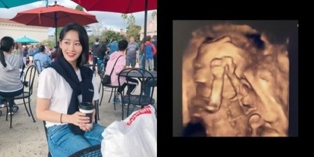 「CRAYON POP」のグンミ（ソン・ボラム）、第二子妊娠＆出産100日前を電撃告白メンバーたちも祝福(WoW!Korea)