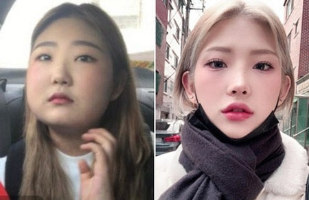 “ループス病”故チェ・ジンシルさん娘チェ・ジュンヒ、96kg→52kg減量の秘訣公開(WoW!Korea)