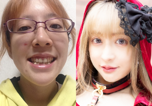 【整形美女】大切な人の死で自暴自棄になり整形を決意　総額2500万円をかけたレイヤー「周りに感謝できるようになった」(オリコン)