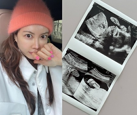 女優ヤン・ミラ、妊娠20週の超音波写真公開「女の子なのに足が平たい」(WoW!Korea)