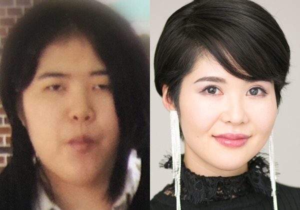 「美醜から離れたところで生きたい」美容整形に700万かけた女性がコンプレックスを乗り越えた先に見つけた新たな夢(オリコン)