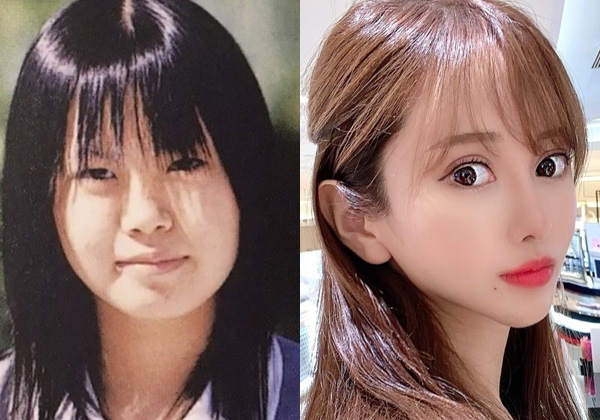 異性から「ブス」、存在を無視…屈辱的な扱いを受けた女性　生き方をも変えた1000万以上の美容整形を通して伝えたい想い(オリコン)