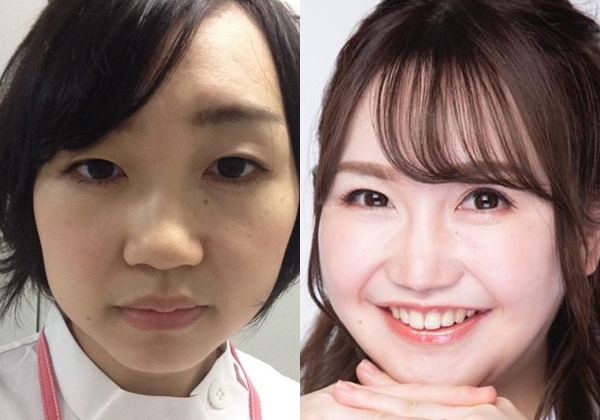 【整形美女】「整形して美容整形外科医になれてよかった」15回施術を重ねた女性が“手術される側”から“施す側”になった理由(オリコン)