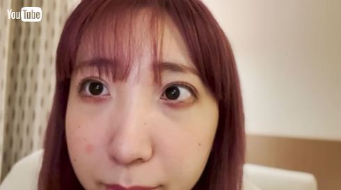 パーパー・あいなぷぅ、“パンパンに腫れてた”整形のダウンタイム披露　術後1カ月の完成形に「より可愛くなってる」(ねとらぼ)