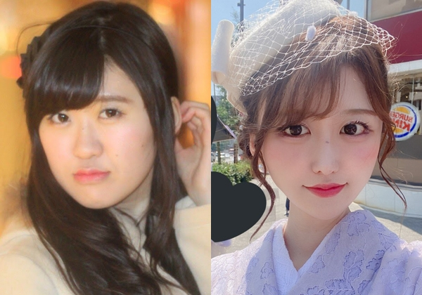 「窮屈に生きなくていいための手段を増やしたい」 整形は自分を幸せにしないとわかっていても突き進む理由(オリコン)