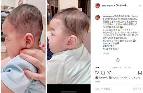 稲垣早希、0歳息子の“ヘルメット治療”前後の姿を公開　頭部の形が大幅改善に「思い切ってやって良かった」（ねとらぼ）
