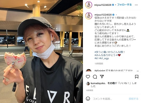 美容師ファイター・菅原美優、K-1決勝で流血したケガの術後ショット公開　「何針縫ったかはわからない」(ねとらぼ)