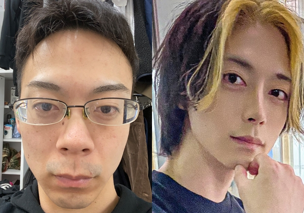 【整形美男】骨延長で158cmから170cmになったホスト　“ガチ陰キャ”から“高橋一生似”の変貌を通して見つけたさらなる“野望”(オリコン)