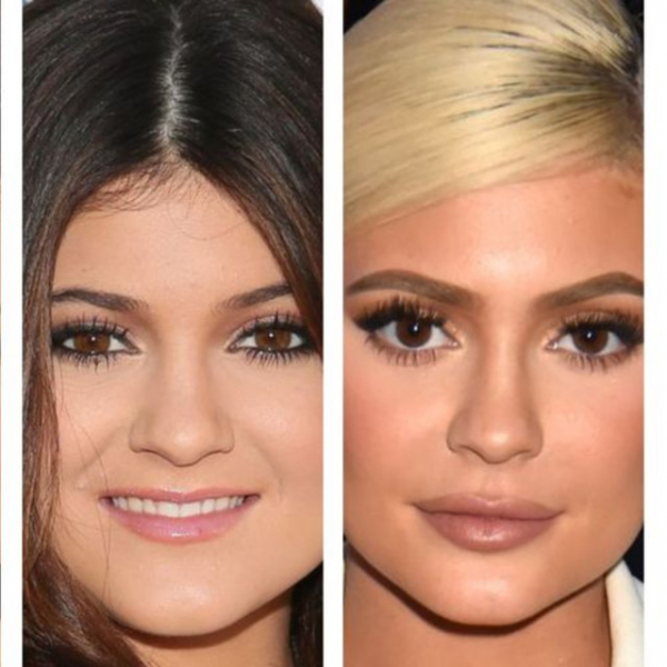 大変貌！カイリー・ジェンナー13年間の「美貌遍歴」を振り返り(コスモポリタン)