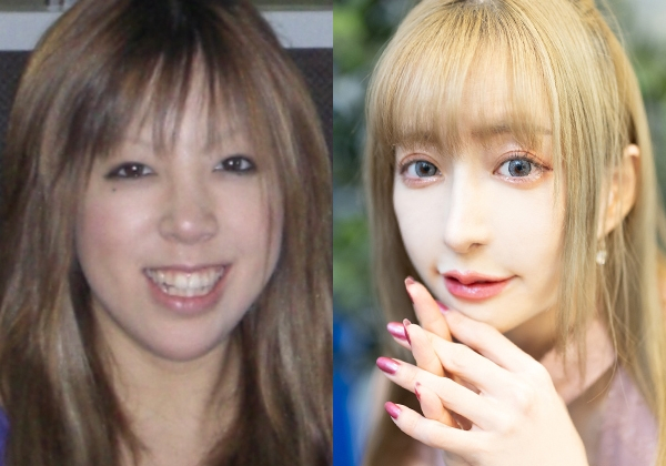 「中身まで変わることで人生も変えられる」大切な人の死乗り越え、2500万円整形にかけたレイヤーがいきついた“答え”(オリコン)