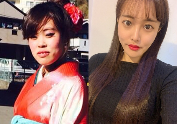 「結局は顔じゃないんだなって」全身の整形に300万投じた女性が美醜に執着しなくなった理由(オリコン)