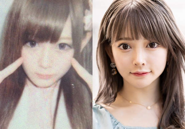 「お前は捨て子だから顔が違うんだ」父の冗談が整形のきっかけに　“かわいい”に憑りつかれていた黒崎みさが見出した妥協点(オリコン)