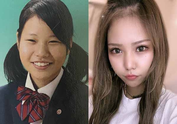 「私の顔の素材が悪いから」「ブサイクに見えるのはどこ?」初めての施術にがっかりした女性が整形を“自分を好きになる手段”と断言できるワケ(オリコン)