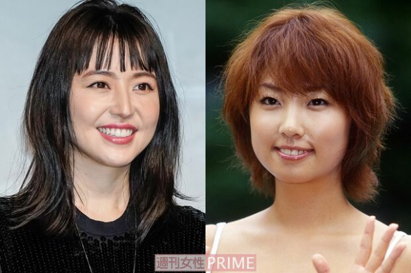 長澤まさみやMEGUMIの「ほうれい線」は老けて見える？ 美容外科医が教える“やるべき対策”(週刊女性PRIME)