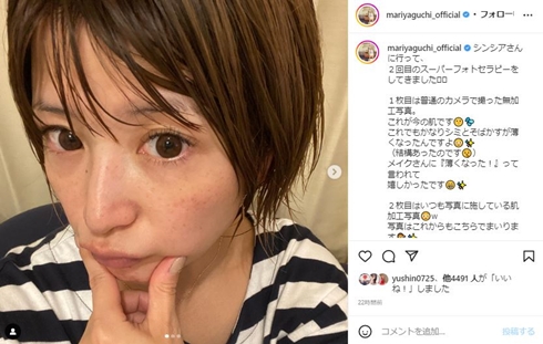 矢口真里、すっぴん＆加工写真の“ビフォーアフター”に「親近感」　40歳目前にシミ・そばかすが濃くなる悩みも(ねとらぼ)
