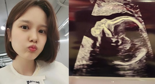 SunnyHillビンナ、結婚から1年で妊娠…「息子をきちんと育てたい」(朝鮮日報日本語版)