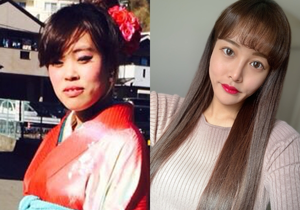 全身に総額300万円を費やし「容姿に執着しなくなった」女性　「SNSを通して“美容整形はいいものだよ”と伝えたい」と語る真意(オリコン)