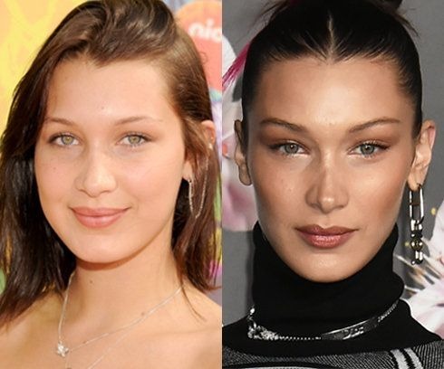 成功or失敗？「鼻の整形」を疑われている海外セレブたち(ELLEgirl)