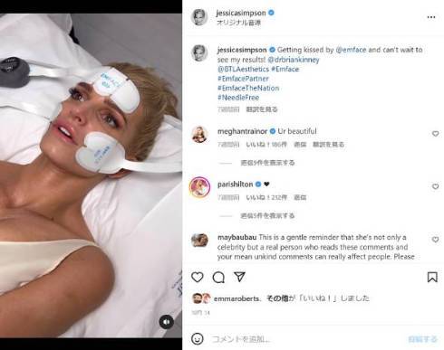 42歳のジェシカ・シンプソン、最新の若返り施術を受けた顔を公開　「別人みたい」と美容整形批判も(ねとらぼ)