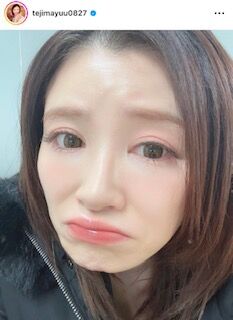 昨年１１月に一般男性と結婚の手島優、じんましんに苦しむ「赤すぎる！！痒いし、痛いし」(スポーツ報知)