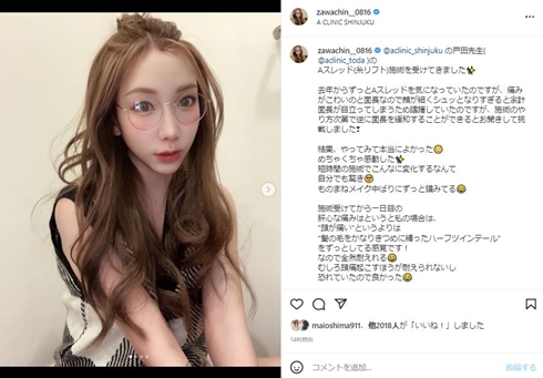 ざわちん、美容整形のビフォーアフターに大満足　気にしていた面長緩和で「メイク中ばりに鏡みてる」「自分でも驚き」(ねとらぼ)