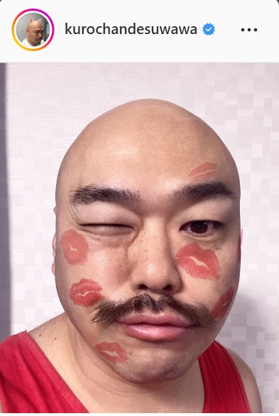 クロちゃん「おはおはチュッチュッ」キスマーク７つ顔写真公開も「浮いてる」早くもバッシング!?(日刊スポーツ)
