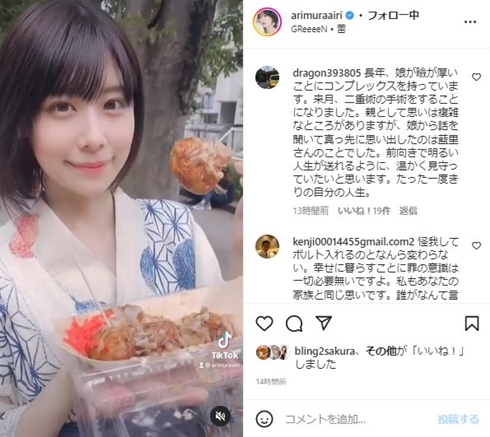 有村藍里、輪郭矯正の“骨切り”直後は「地獄のような時間」　4年たった姿に反響「明るくなった」「すごく素敵」(ねとらぼ)