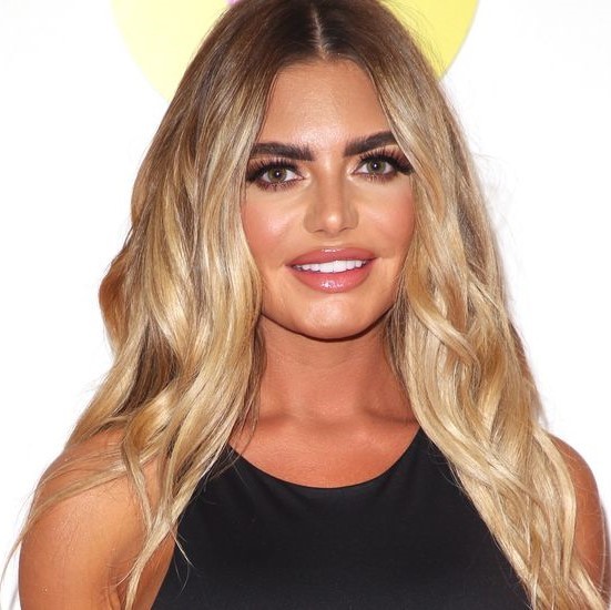 「美容整形は自尊心を向上させるものではない」セレブが依存していた美容整形をやめた理由(コスモポリタン)