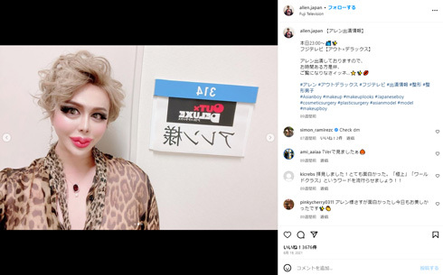 総額1億円超の整形男子・アレン、自転車で“走行禁止”エリアへ侵入しパニック　赤い警光灯に「助けて！」(ねとらぼ)