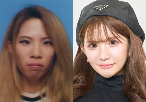 親からの心ない言葉やいじめ、誹謗中傷…壮絶なトラウマを整形で乗り越えた女性たちの覚悟(オリコン)