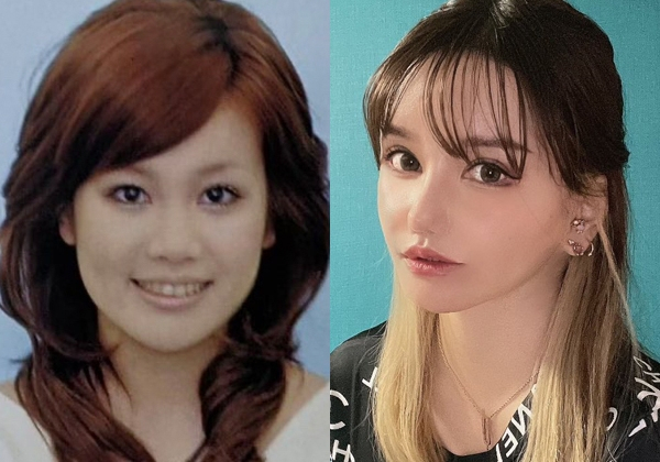 整形に2500万以上かけた女性たち　リスクや覚悟を背負ってたどり着いたそれぞれの“答え”(オリコン)