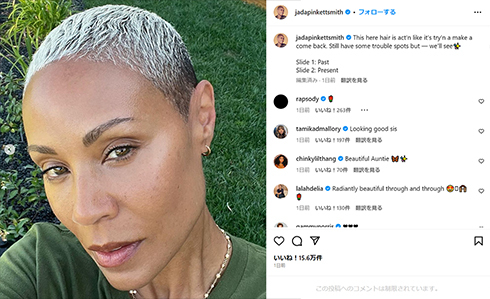 ウィル・スミスの妻ジェイダ、髪が「カムバック」 “脱毛症”ネタにされたことがオスカービンタ事件の発端に(ねとらぼ)