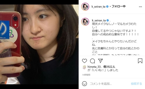 イメチェンした小林星蘭、“自分への戒め”にすっぴんショット公開　「最近顔にすごいお肉ついたの！」(ねとらぼ)