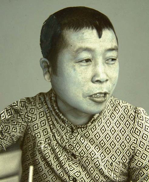 たこ八郎さんの思い出 腕立て伏せの最中、両手を離して床に頭を打ちつけ「やり方、忘れちゃった」って（研ナオコ）(日刊ゲンダイDIGITAL)