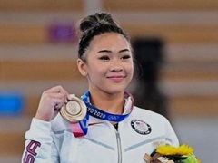 東京五輪女子体操の金メダリスト、腎臓病で“体重20キロ増”　治療法ないままパリ目指す20歳にエール殺到(ねとらぼ)